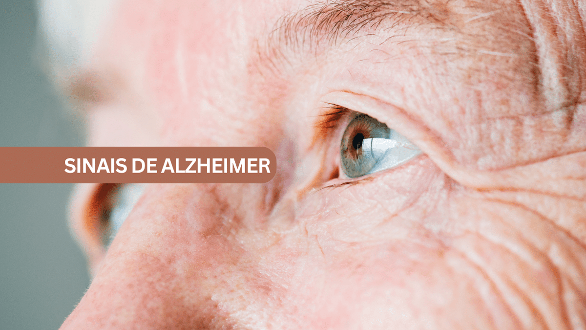 Alzheimer
