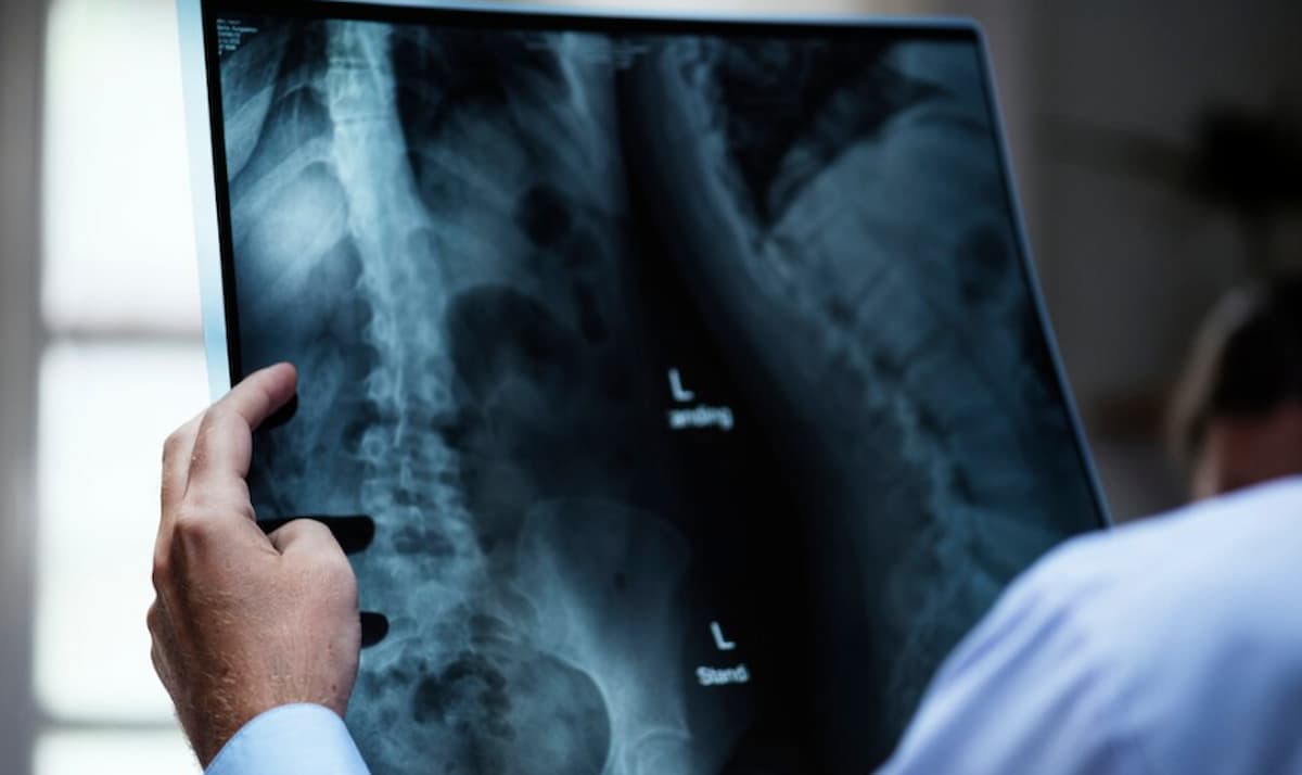 Radiologistas asseguram segurança em exames de tomografia